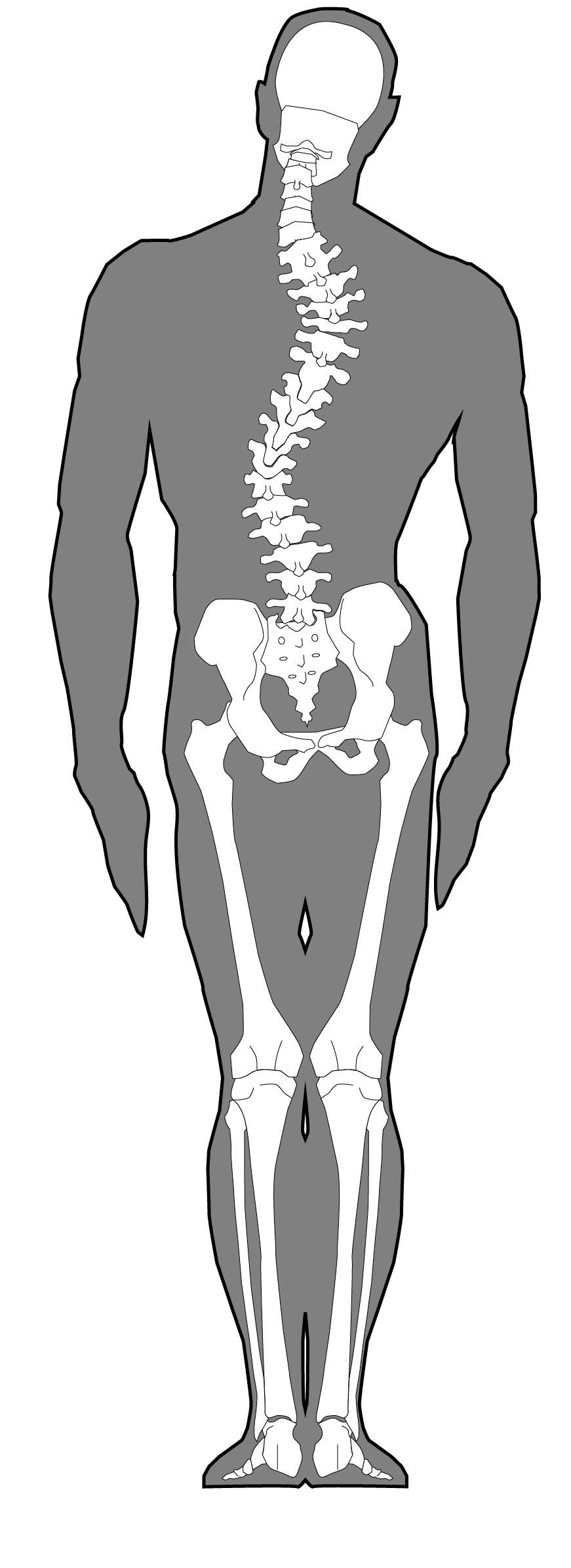 <span>3.</span>骨格による腰痛