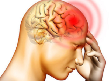 首の回旋時における頭痛と吐き気