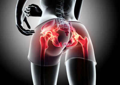 <span>2.</span>股関節と腰痛の関係
