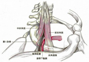 <span>2.</span>斜角筋症候群