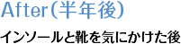 After(半年後) インソールと靴を気にかけた後