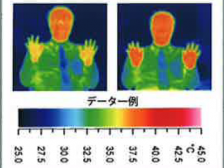 <span>2.</span>酸素カプセル美容法