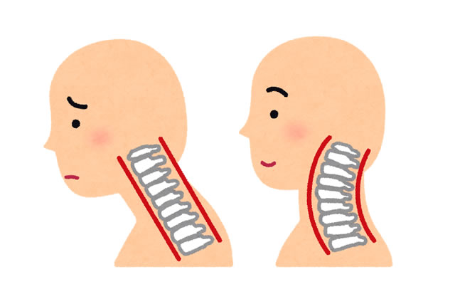 浦安整体日記-1診目-「整形外科でストレートネックと言われました・・・」４０代男性