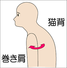 巻き肩と猫背の関係